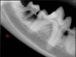 canine molar loose and abscess