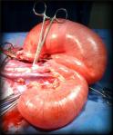 2-pounds of uterus in a 9 1/2 pound chihuahua!