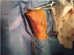 Post lump removal incision on a Labrador Retriever's leg