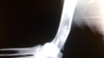 x-ray of the elbow and distal humerus long bone of a puppy