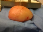 Yellow-orange rounded blob of dog fat seen from the side.  Surprisingly, the surface is a little crinkly and dry, not greasy because of the connective tissue poncho the lump lived inside.