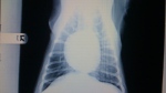 top-to-bottom (V/D) view of a normal dog's chest x-ray