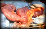 The dog uterus exteriorized as shown from the front, the Y shape is flipped back because the ovaries are already detached.