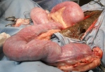 Another view of the large, diseased uterus
