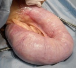 This uterus horn is rounded and bulging from the pressure of the pus build-up inside.