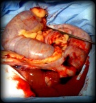 After surgery, Doc Truli cut the uterus to show the brown-red foul-smelling pus inside